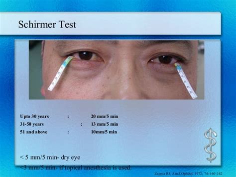 tear breakup time test procedure|schirmer test for dry eye.